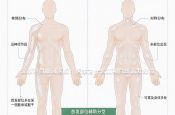 武汉京科白癜风医院：医生为什么重视白斑首发部位
