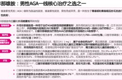 从害怕到接受：一位患者对非那雄胺副作用的认知转变
